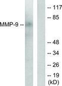 Anti-MMP-9 antibody produced in rabbit affinity isolated antibody