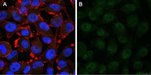 Anti-Notch1 Antibody, clone 1A32 ZooMAb&#174; Rabbit Monoclonal recombinant, expressed in HEK 293 cells