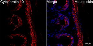 Anti-Cytokeratin 10 Antibody, clone 4S5Y7, Rabbit Monoclonal