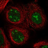 Anti-NCL antibody produced in rabbit Prestige Antibodies&#174; Powered by Atlas Antibodies, affinity isolated antibody, buffered aqueous glycerol solution