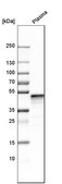 Anti-SERPINF1 antibody produced in rabbit Prestige Antibodies&#174; Powered by Atlas Antibodies, affinity isolated antibody, buffered aqueous glycerol solution