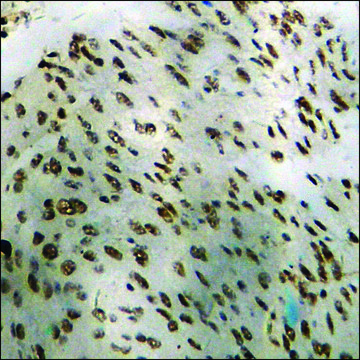 Anti-phospho-DDX3/DEAD-box Protein 3 (pThr322) antibody produced in rabbit affinity isolated antibody