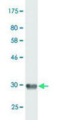 Monoclonal Anti-EMR4P antibody produced in mouse clone 1G10, purified immunoglobulin, buffered aqueous solution