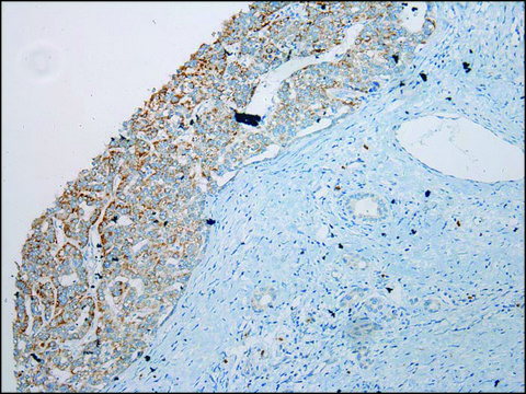 Anti-SLC6A19 affinity isolated antibody