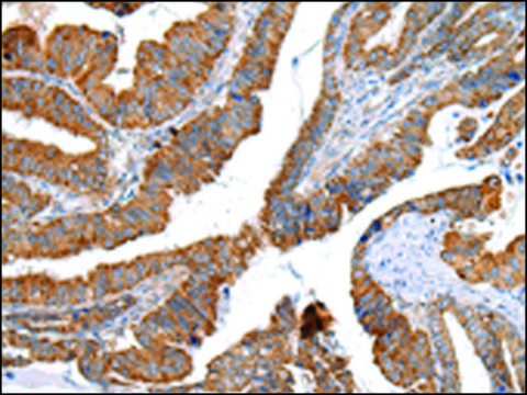 Anti-XKR4 affinity isolated antibody