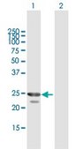 Anti-HPGD antibody produced in mouse purified immunoglobulin, buffered aqueous solution