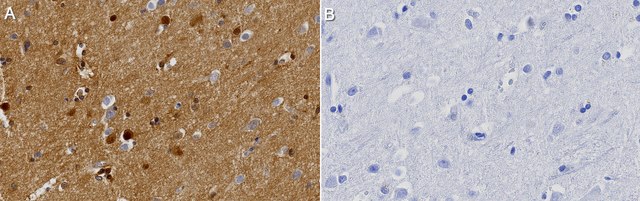 Anti-PTPRZ1 Antibody, clone 1J4 ZooMAb&#174; Rabbit Monoclonal recombinant, expressed in HEK 293 cells