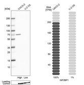 Anti-IGF2BP1 antibody produced in rabbit Prestige Antibodies&#174; Powered by Atlas Antibodies, affinity isolated antibody, buffered aqueous glycerol solution
