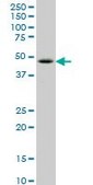 ANTI-LHX6 antibody produced in mouse clone 2A2, purified immunoglobulin, buffered aqueous solution