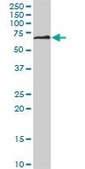 Monoclonal Anti-DPYSL5 antibody produced in mouse clone 2D10, purified immunoglobulin, buffered aqueous solution