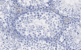 Anti-IDH1 Antibody, clone 1M9 ZooMAb&#174; Rabbit Monoclonal recombinant, expressed in HEK 293 cells