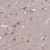 Anti-TBCB antibody produced in rabbit Prestige Antibodies&#174; Powered by Atlas Antibodies, affinity isolated antibody, buffered aqueous glycerol solution