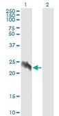 Monoclonal Anti-EIF5A2 antibody produced in mouse clone 1E7, purified immunoglobulin, buffered aqueous solution
