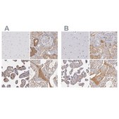 Anti-SERPINA1 antibody produced in rabbit Prestige Antibodies&#174; Powered by Atlas Antibodies, affinity isolated antibody, buffered aqueous glycerol solution