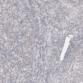 Anti-ITGA6 antibody produced in rabbit Prestige Antibodies&#174; Powered by Atlas Antibodies, affinity isolated antibody, buffered aqueous glycerol solution