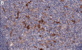 Anti-IRE1α Antibody, clone 1F9 ZooMAb&#174; Rabbit Monoclonal recombinant, expressed in HEK 293 cells