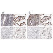 Anti-PBX1 antibody produced in rabbit Prestige Antibodies&#174; Powered by Atlas Antibodies, affinity isolated antibody, buffered aqueous glycerol solution