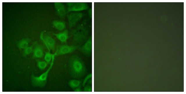 Anti-TIMP2 antibody produced in rabbit affinity isolated antibody