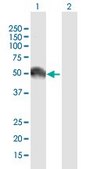 Anti-EGFR antibody produced in mouse purified immunoglobulin, buffered aqueous solution