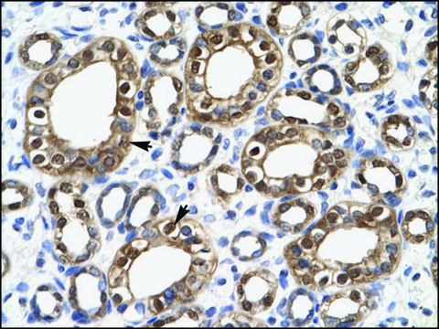 Anti-ENO1 antibody produced in rabbit affinity isolated antibody