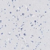Anti-IL16 antibody produced in rabbit Prestige Antibodies&#174; Powered by Atlas Antibodies, affinity isolated antibody, buffered aqueous glycerol solution