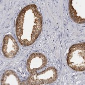 Anti-SLC25A22 antibody produced in rabbit Prestige Antibodies&#174; Powered by Atlas Antibodies, affinity isolated antibody, buffered aqueous glycerol solution