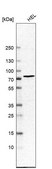 Anti-CHEK2 antibody produced in rabbit Prestige Antibodies&#174; Powered by Atlas Antibodies, affinity isolated antibody, buffered aqueous glycerol solution