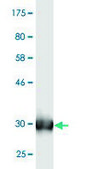 Monoclonal Anti-SLC13A5 antibody produced in mouse clone 2G4, purified immunoglobulin, buffered aqueous solution