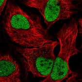 Anti-PDE7B antibody produced in rabbit Prestige Antibodies&#174; Powered by Atlas Antibodies, affinity isolated antibody, buffered aqueous glycerol solution