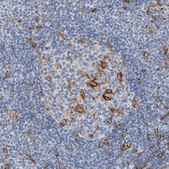 Anti-SKAP2 antibody produced in rabbit Prestige Antibodies&#174; Powered by Atlas Antibodies, affinity isolated antibody, buffered aqueous glycerol solution