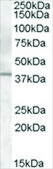 Anti-IL12B/IL12P40 (AB2) antibody produced in goat affinity isolated antibody, buffered aqueous solution