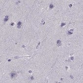 Anti-CALCR antibody produced in rabbit Prestige Antibodies&#174; Powered by Atlas Antibodies, affinity isolated antibody, buffered aqueous glycerol solution