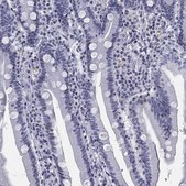 Anti-CCDC144A antibody produced in rabbit Prestige Antibodies&#174; Powered by Atlas Antibodies, affinity isolated antibody, buffered aqueous glycerol solution