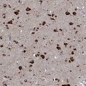 Anti-NACAD antibody produced in rabbit Prestige Antibodies&#174; Powered by Atlas Antibodies, affinity isolated antibody, buffered aqueous glycerol solution