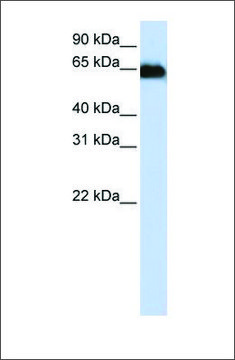 Anti-ADAM12 antibody produced in rabbit affinity isolated antibody