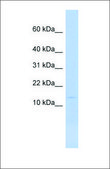 Anti-MYL6 (ab2) antibody produced in rabbit affinity isolated antibody