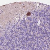 Anti-NOS1AP antibody produced in rabbit Prestige Antibodies&#174; Powered by Atlas Antibodies, affinity isolated antibody, buffered aqueous glycerol solution