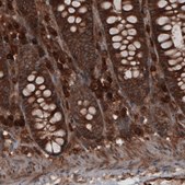 Monoclonal Anti-CARS antibody produced in mouse Prestige Antibodies&#174; Powered by Atlas Antibodies, clone CL2309, purified immunoglobulin, buffered aqueous glycerol solution