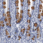 Anti-GNAS antibody produced in rabbit Prestige Antibodies&#174; Powered by Atlas Antibodies, affinity isolated antibody, buffered aqueous glycerol solution