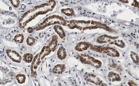Anti-Smad3 Antibody, clone 1J11, ZooMAb&#174; Rabbit Monoclonal recombinant, expressed in HEK 293 cells