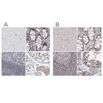 Anti-UIMC1 antibody produced in rabbit Prestige Antibodies&#174; Powered by Atlas Antibodies, affinity isolated antibody, buffered aqueous glycerol solution