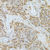 Anti-CAP1 Antibody, clone 9K4I6, Rabbit Monoclonal