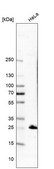 Anti-MEOX1 antibody produced in rabbit Prestige Antibodies&#174; Powered by Atlas Antibodies, affinity isolated antibody, buffered aqueous glycerol solution