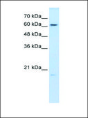 Anti-GPX3 antibody produced in rabbit affinity isolated antibody
