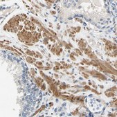 Anti-SLC27A6 antibody produced in rabbit Prestige Antibodies&#174; Powered by Atlas Antibodies, affinity isolated antibody, buffered aqueous glycerol solution