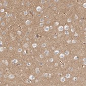Anti-MPRIP antibody produced in rabbit Prestige Antibodies&#174; Powered by Atlas Antibodies, affinity isolated antibody, buffered aqueous glycerol solution, Ab2