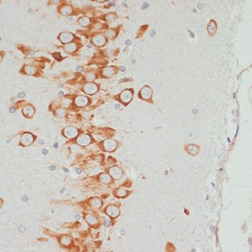 Anti-Phospho-VASP-S157 antibody produced in rabbit