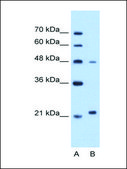 Anti-MMP1 IgG fraction of antiserum
