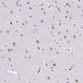 Anti-SBNO1 antibody produced in rabbit Prestige Antibodies&#174; Powered by Atlas Antibodies, affinity isolated antibody, buffered aqueous glycerol solution