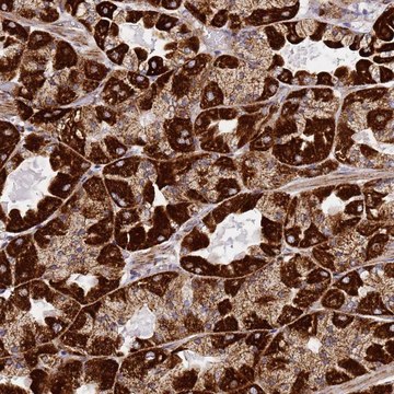 Anti-NDUFA3 antibody produced in rabbit Prestige Antibodies&#174; Powered by Atlas Antibodies, affinity isolated antibody, buffered aqueous glycerol solution